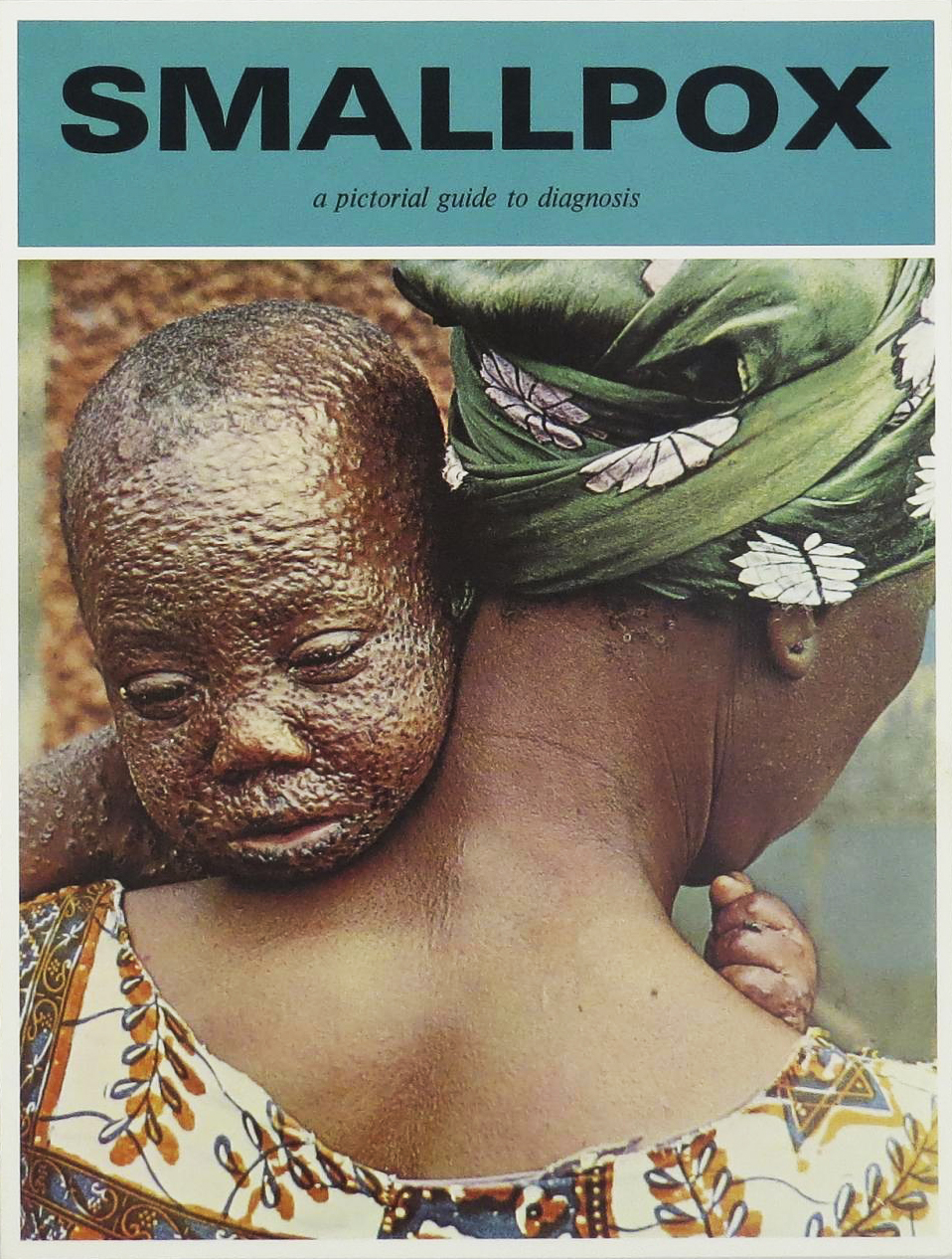 Pamphlet with a photo of a child covered in smallpox blisters