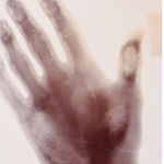 an x-ray of a hand