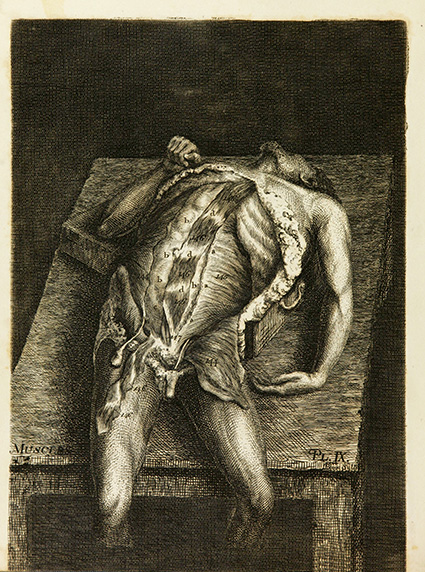 Drawing of cadaver on dissection table