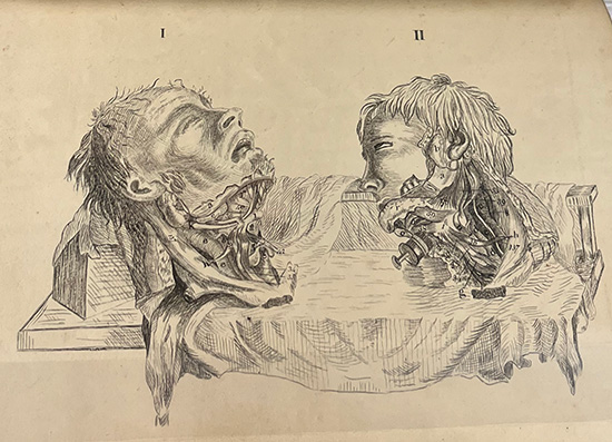 John Brettell's sketch copying an illustration from Bell's book