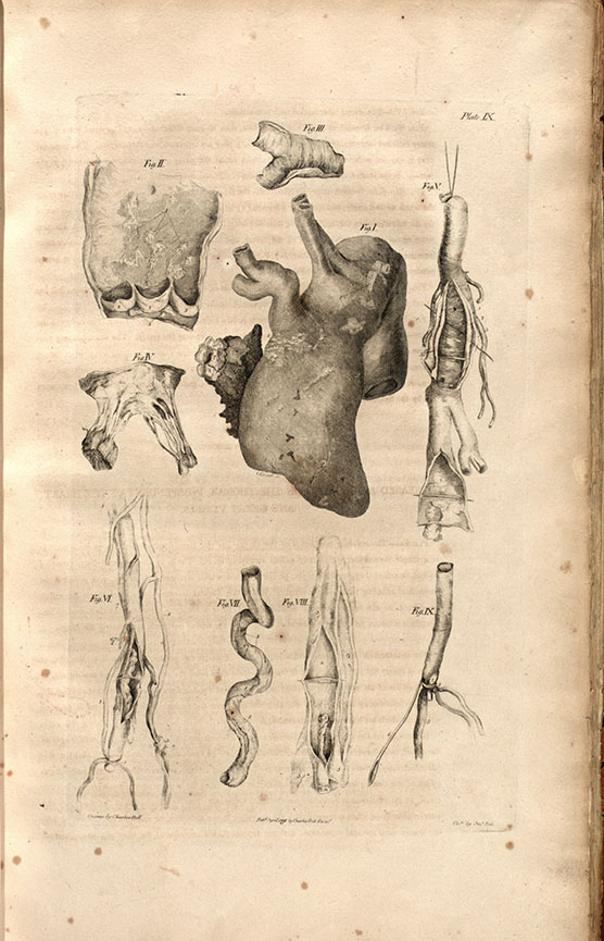 Illustration of the heart, drawn and etched by Charles Bell