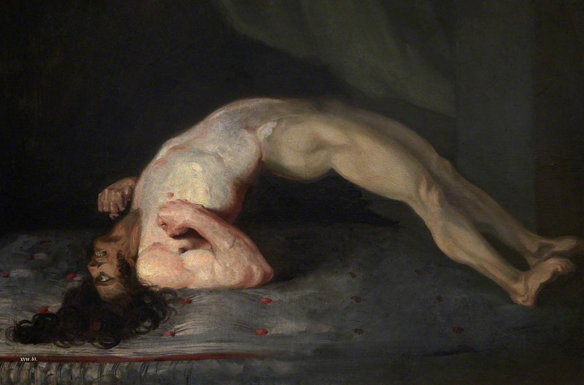 The Wounded following the Battle of Corunna: Tetanus Following Gunshot Wounds. Painted by Charles Bell