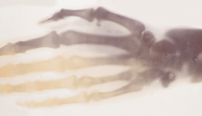x-ray positive image of a hand
