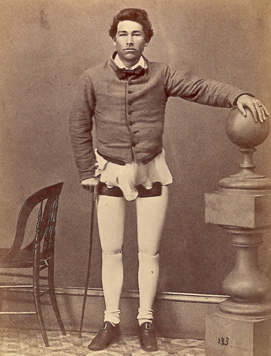 Private Rush standing on artificial legs