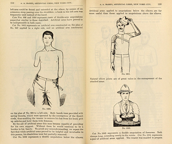 Scanned page from a treatise on artificial limbs with rubber hands and feet.