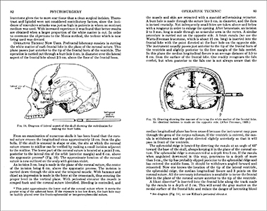 Steps14_Psychosurgery